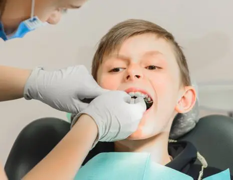 Early Signs Your Child May Need Myobrace