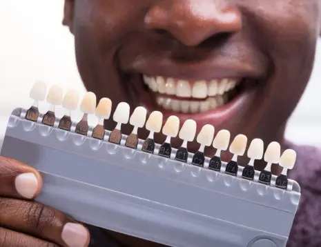 Choosing the Right Denture Shade