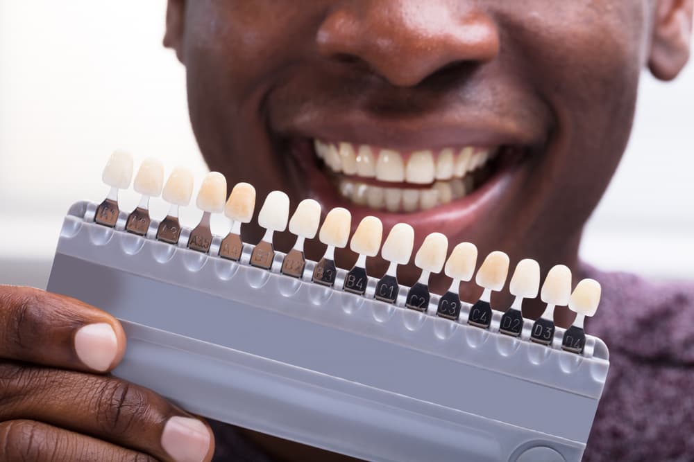 denture shade